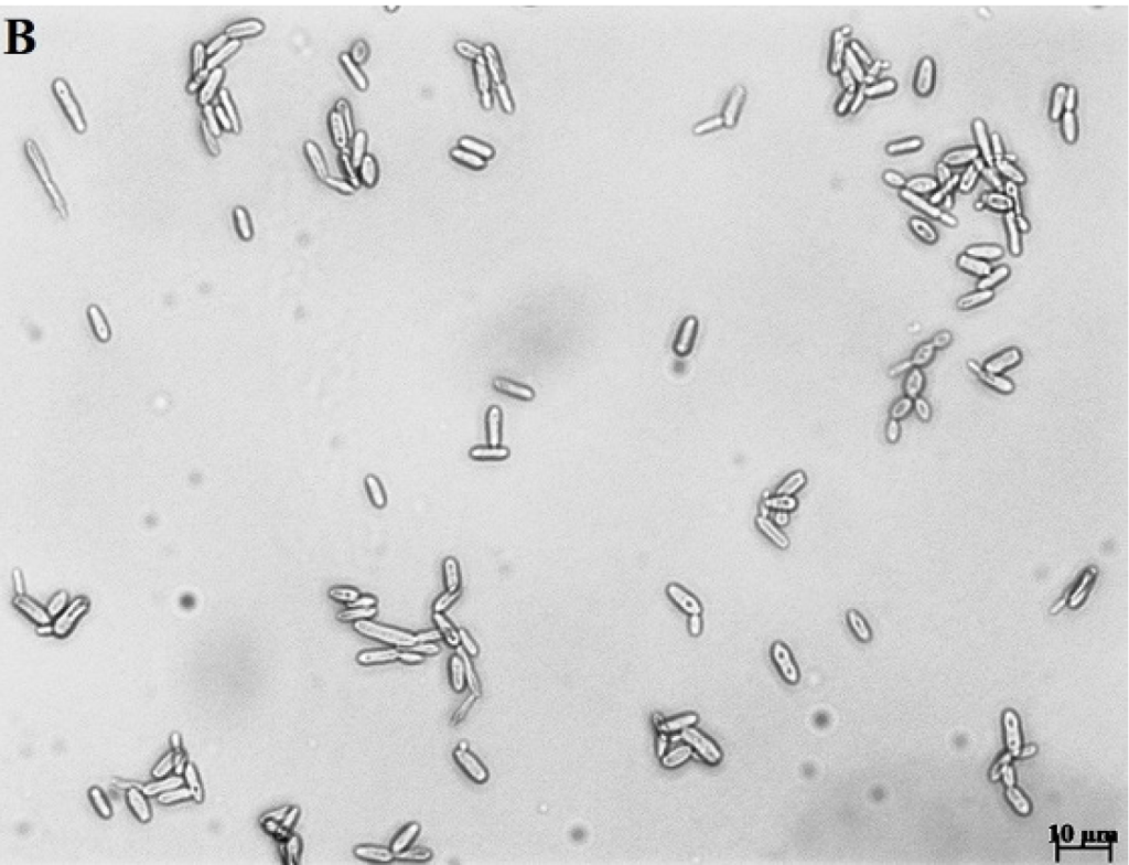 Células levaduriformes de Sporothrix brasiliensis observadas al microscopio, imagen científica contextual